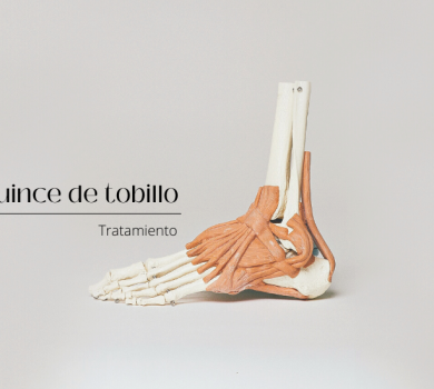 esguince de tobillo