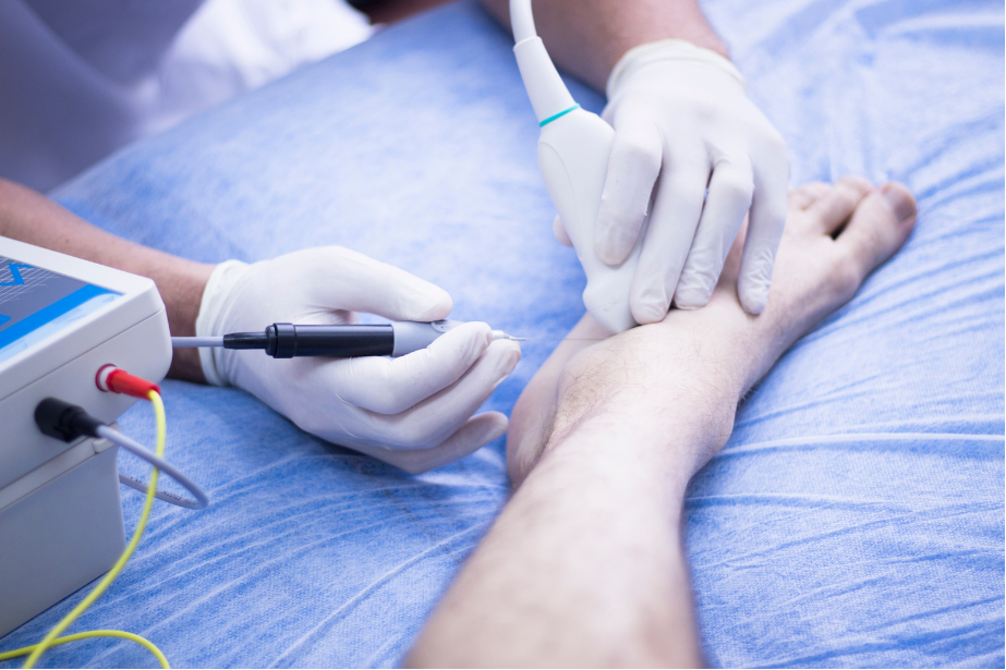 electrolisis percutanea intratisular en moncada